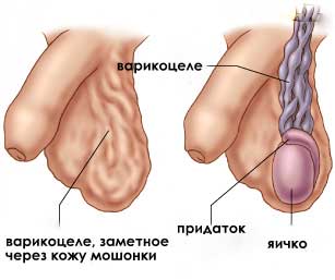 Фотография к новости Лечение болезней связанных с яичками у мужчин